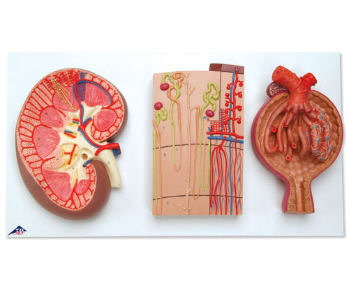 IIλѪܺIСwģ